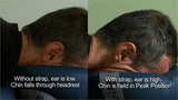 Nirvana ERGOFIX Face Support System Complete Package